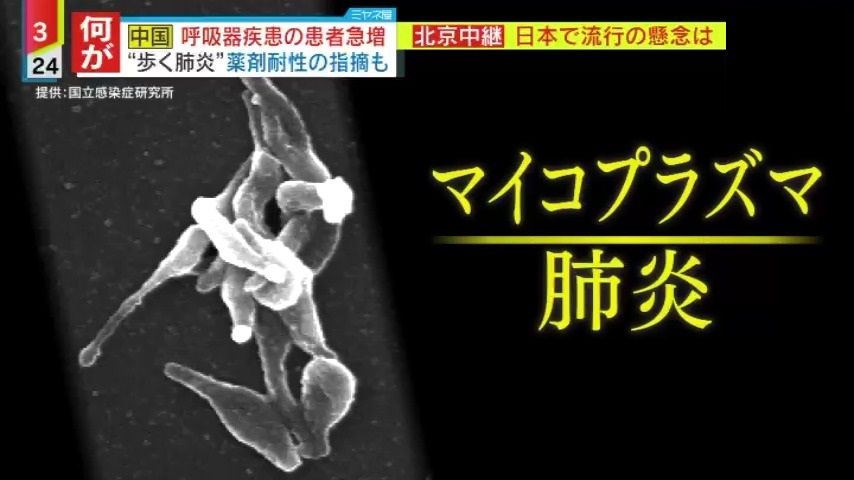 流行の一つ「マイコプラズマ肺炎」