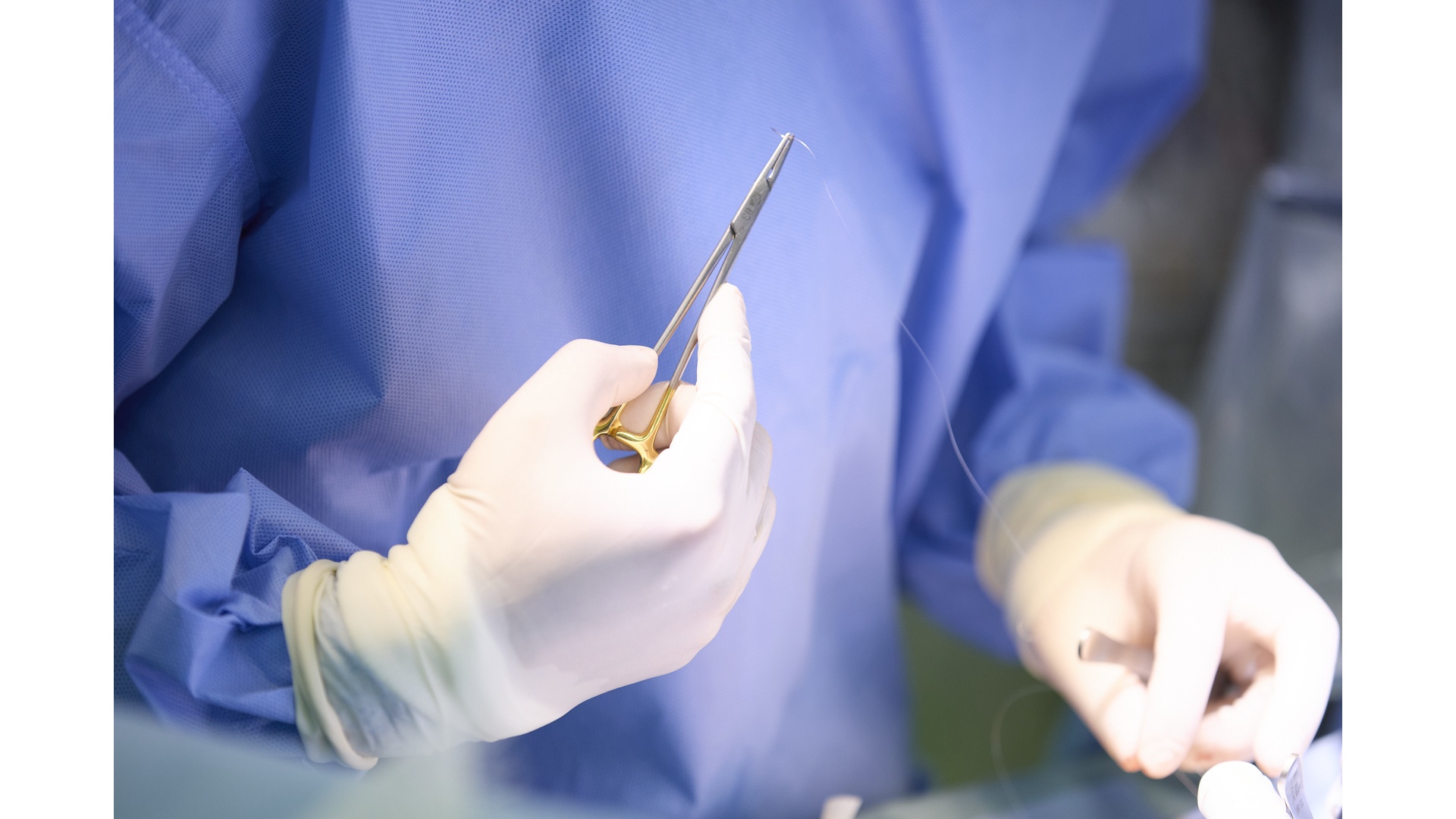 医療危機】“未来の外科医療”を守るため…大阪大学の小児外科医らがAI