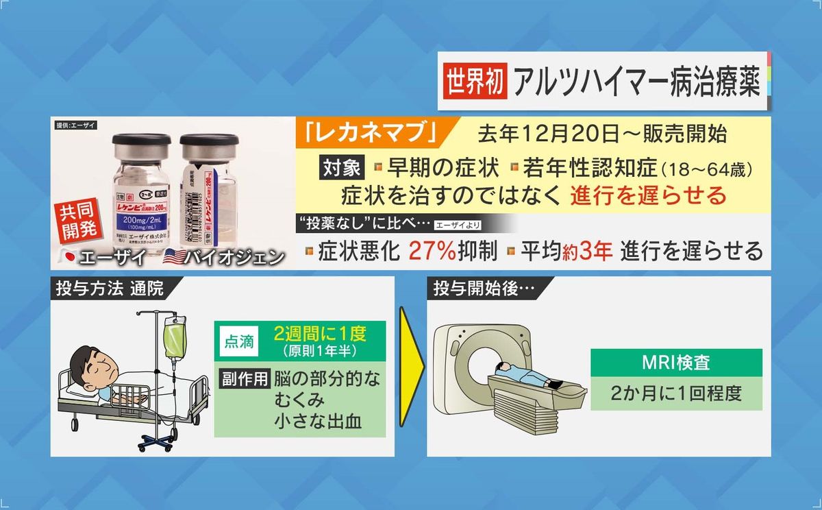 世界初のアルツハイマー病治療薬「レカネマブ」