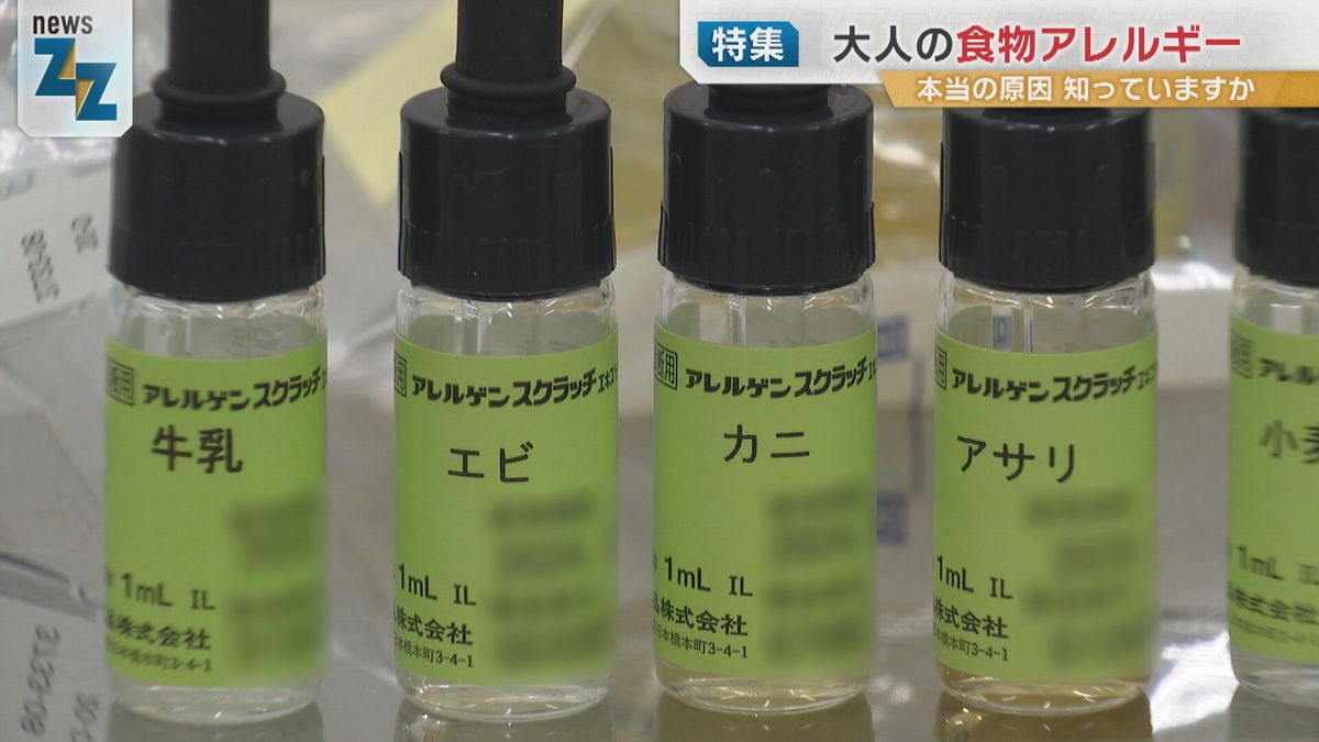 【特集】花粉症と意外な関係も？増加する『大人の食物アレルギー』治療薬の開発現場のいま