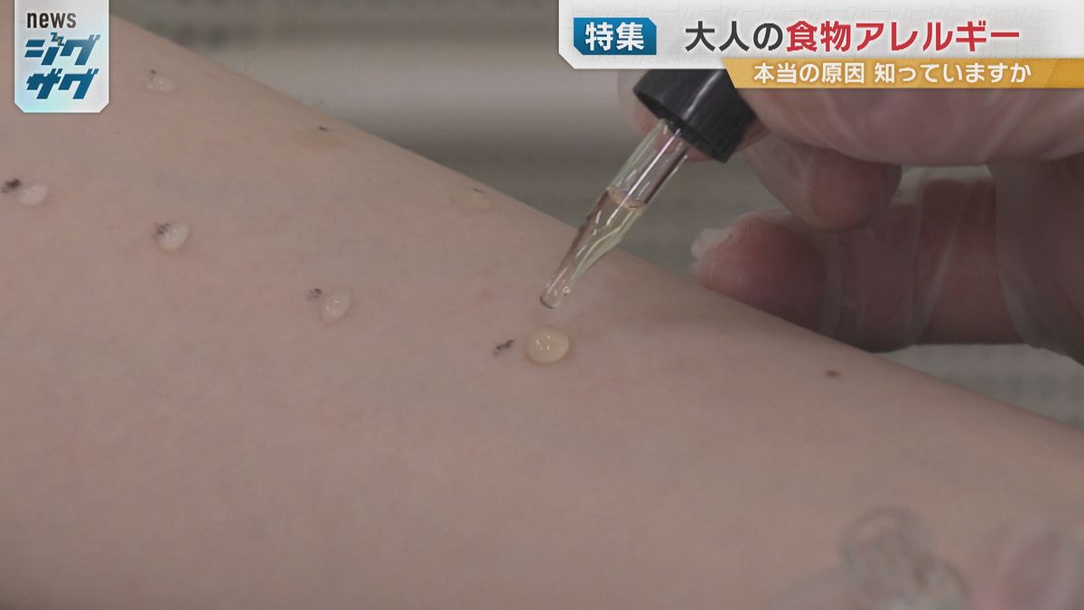 プリックテストの様子