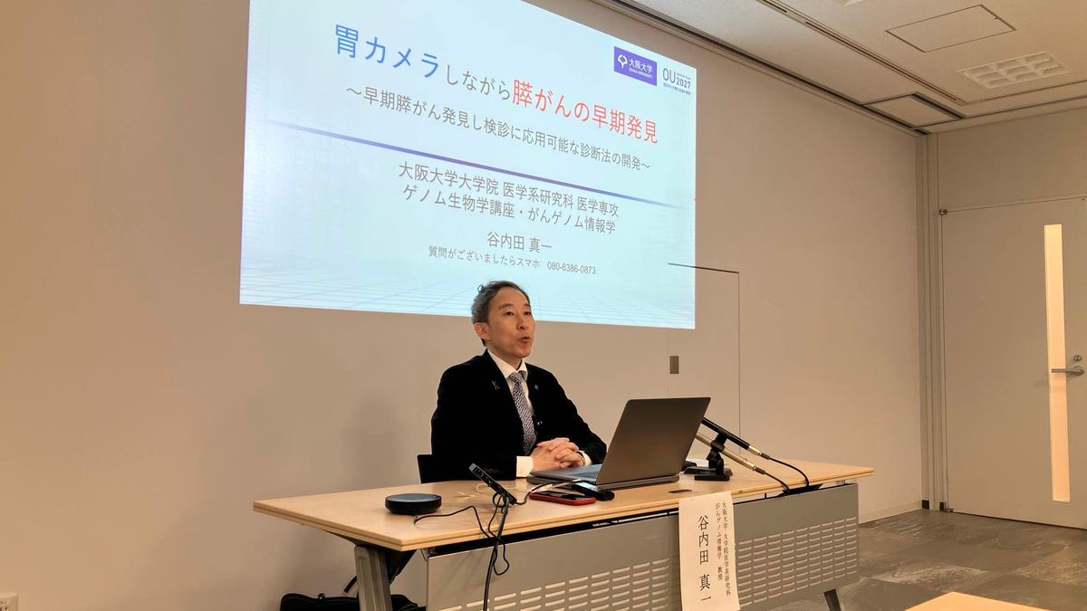 【速報】胃カメラをしながら「膵がん」早期の発見が可能に　5年生存率は約10％“治療難しい”膵がん細胞の検出方法を開発「膵がん克服に向けた第一歩」大阪大学などの研究グループ